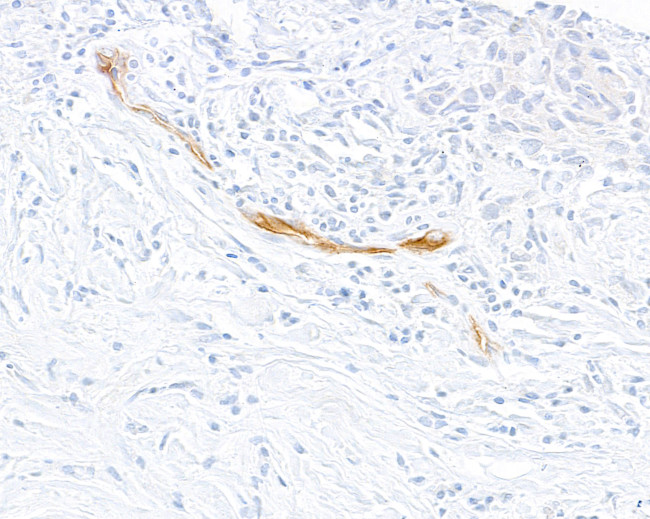 E-Selectin/CD62E Antibody in Immunohistochemistry (Paraffin) (IHC (P))