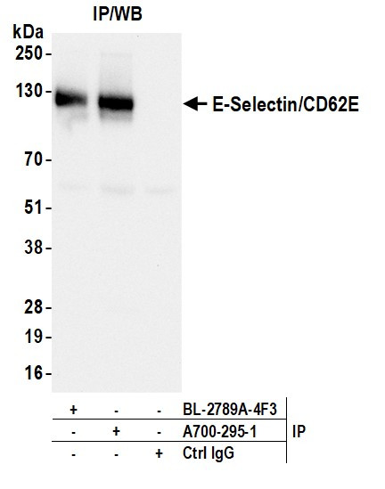 E-Selectin/CD62E Antibody in Immunoprecipitation (IP)