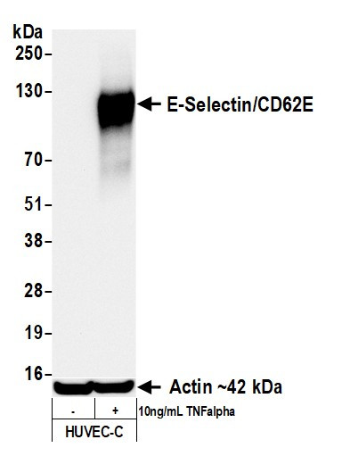 E-Selectin/CD62E Antibody in Western Blot (WB)