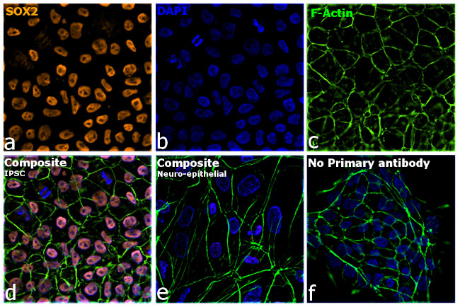 Rat IgG (H+L) Highly Cross-Adsorbed Secondary Antibody in Immunocytochemistry (ICC/IF)