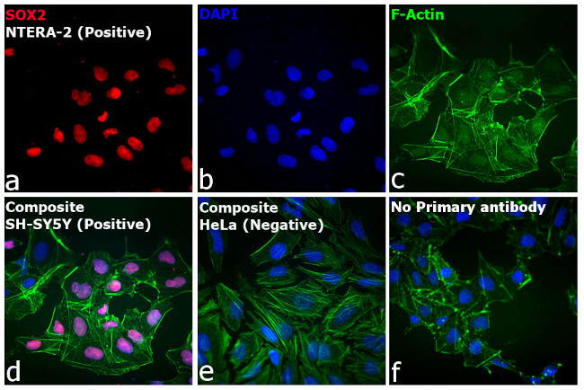 Rat IgG (H+L) Highly Cross-Adsorbed Secondary Antibody in Immunocytochemistry (ICC/IF)