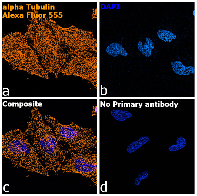 Rat IgG (H+L) Highly Cross-Adsorbed Secondary Antibody in Immunocytochemistry (ICC/IF)