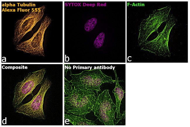 Rat IgG (H+L) Highly Cross-Adsorbed Secondary Antibody in Immunocytochemistry (ICC/IF)