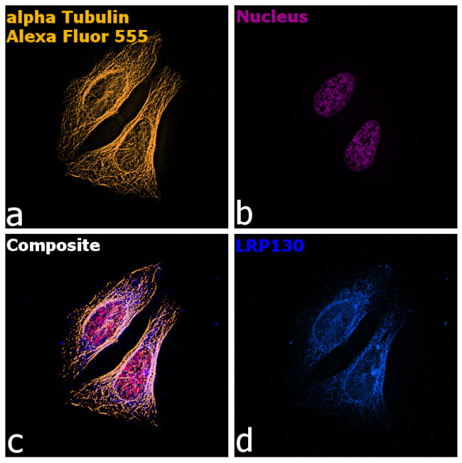 Rat IgG (H+L) Highly Cross-Adsorbed Secondary Antibody in Immunocytochemistry (ICC/IF)