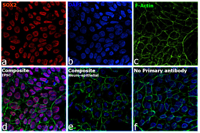 Rat IgG (H+L) Highly Cross-Adsorbed Secondary Antibody in Immunocytochemistry (ICC/IF)