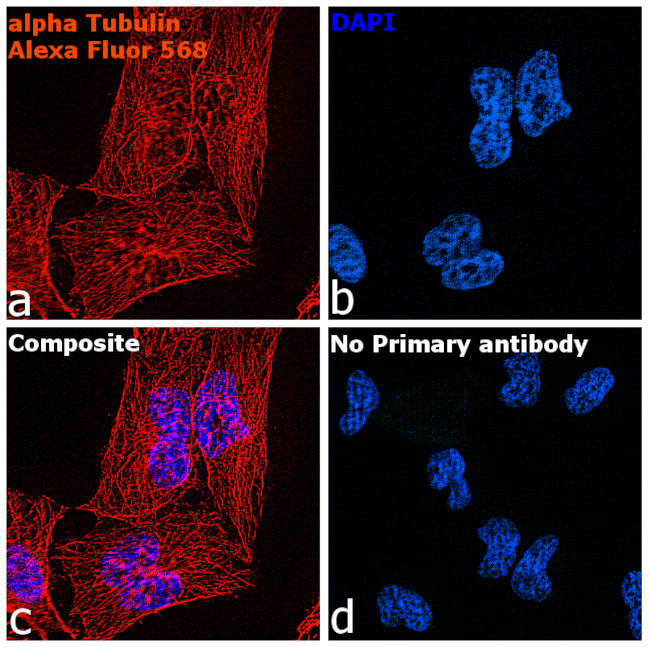 Rat IgG (H+L) Highly Cross-Adsorbed Secondary Antibody in Immunocytochemistry (ICC/IF)