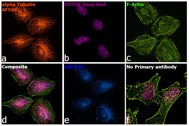 Rat IgG (H+L) Highly Cross-Adsorbed Secondary Antibody in Immunocytochemistry (ICC/IF)