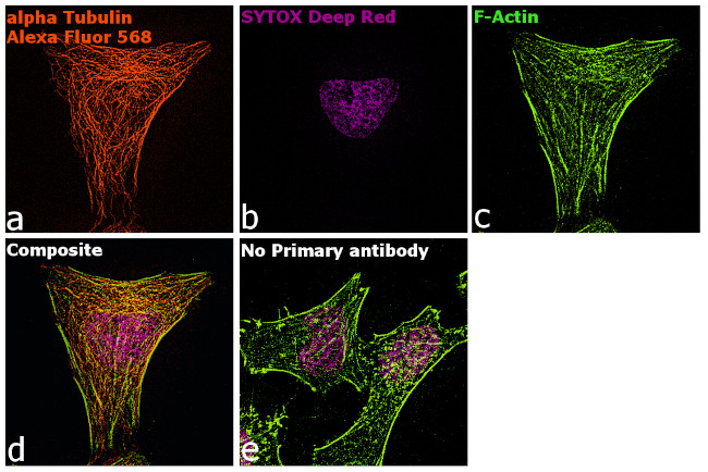 Rat IgG (H+L) Highly Cross-Adsorbed Secondary Antibody in Immunocytochemistry (ICC/IF)