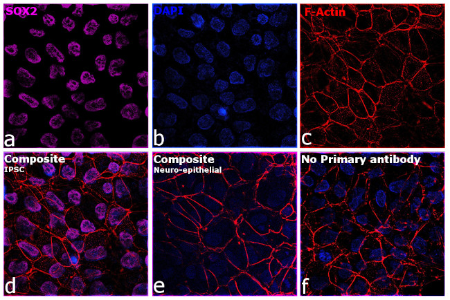 Rat IgG (H+L) Highly Cross-Adsorbed Secondary Antibody in Immunocytochemistry (ICC/IF)