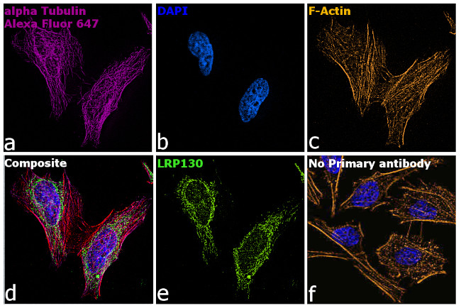 Rat IgG (H+L) Highly Cross-Adsorbed Secondary Antibody in Immunocytochemistry (ICC/IF)