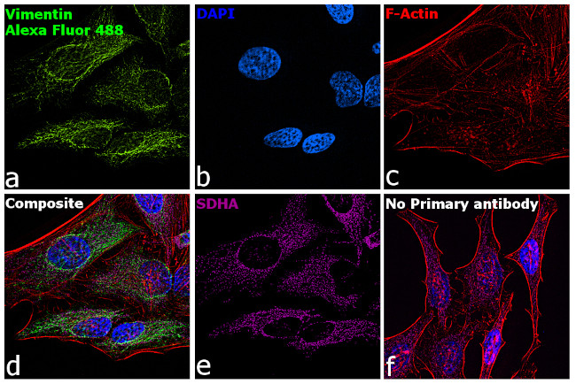 Chicken IgY (H+L) Highly Cross Adsorbed Secondary Antibody in Immunocytochemistry (ICC/IF)