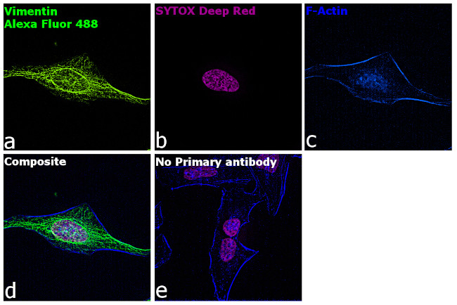 Chicken IgY (H+L) Highly Cross Adsorbed Secondary Antibody in Immunocytochemistry (ICC/IF)