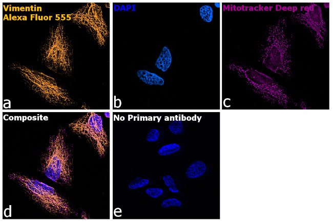 Chicken IgY (H+L) Highly Cross Adsorbed Secondary Antibody in Immunocytochemistry (ICC/IF)