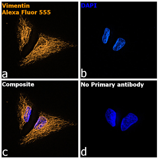 Chicken IgY (H+L) Highly Cross Adsorbed Secondary Antibody in Immunocytochemistry (ICC/IF)