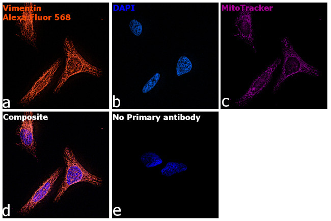 Chicken IgY (H+L) Highly Cross Adsorbed Secondary Antibody in Immunocytochemistry (ICC/IF)