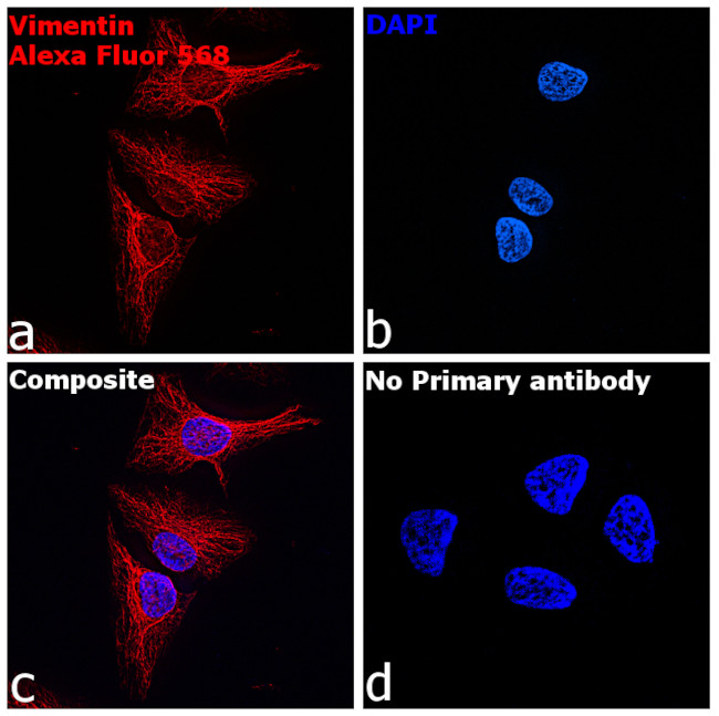 Chicken IgY (H+L) Highly Cross Adsorbed Secondary Antibody in Immunocytochemistry (ICC/IF)