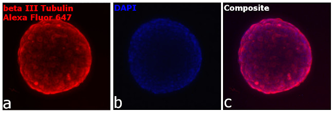 Chicken IgY (H+L) Highly Cross Adsorbed Secondary Antibody in Immunocytochemistry (ICC/IF)