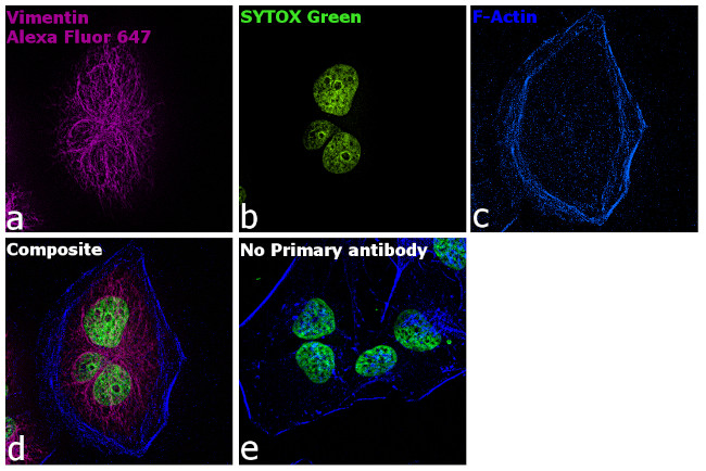 Chicken IgY (H+L) Highly Cross Adsorbed Secondary Antibody in Immunocytochemistry (ICC/IF)