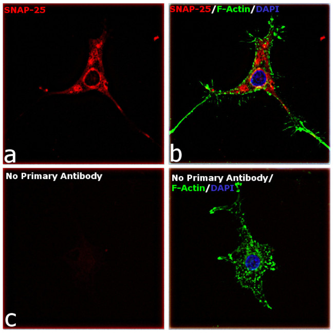 Rabbit IgG Fc, Cross-Adsorbed Secondary Antibody in Immunocytochemistry (ICC/IF)