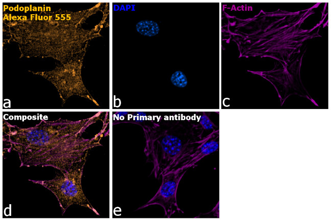 Syrian Hamster IgG (H+L) Highly Cross-Adsorbed Secondary Antibody in Immunocytochemistry (ICC/IF)