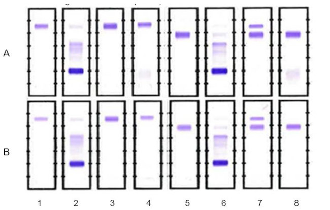 Daratumumab Antibody in Immunoelectrophoresis (IE)