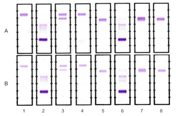 Elotuzumab Antibody in Immunoelectrophoresis (IE)