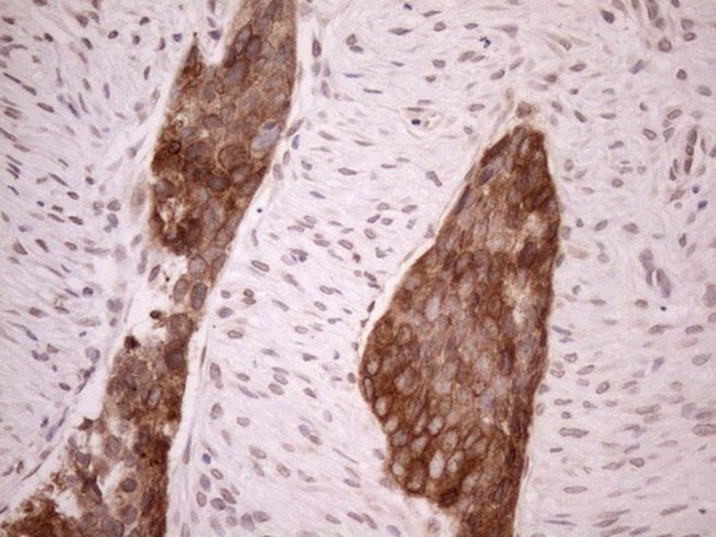 AAAS Antibody in Immunohistochemistry (Paraffin) (IHC (P))