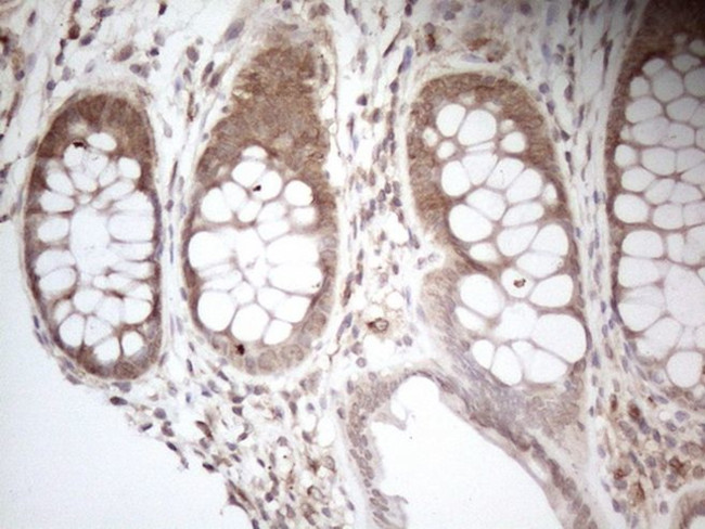 AAAS Antibody in Immunohistochemistry (Paraffin) (IHC (P))