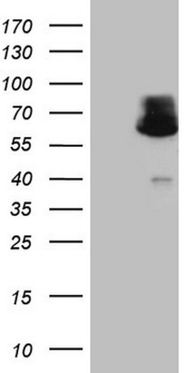 AAAS Antibody in Western Blot (WB)