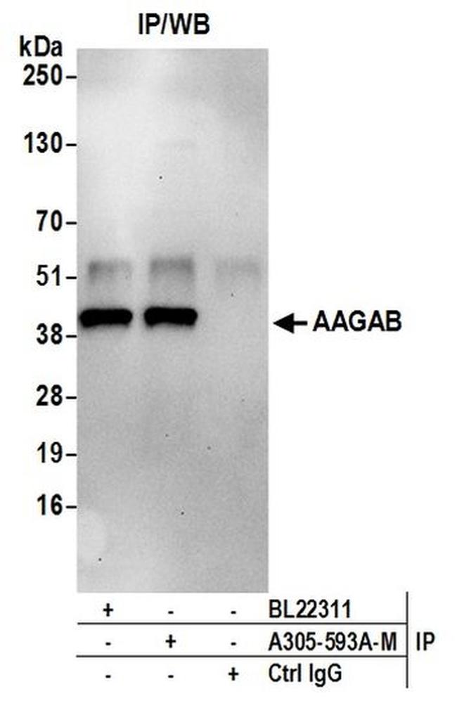 AAGAB Antibody in Western Blot (WB)