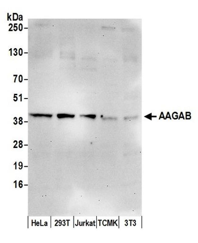 AAGAB Antibody in Western Blot (WB)