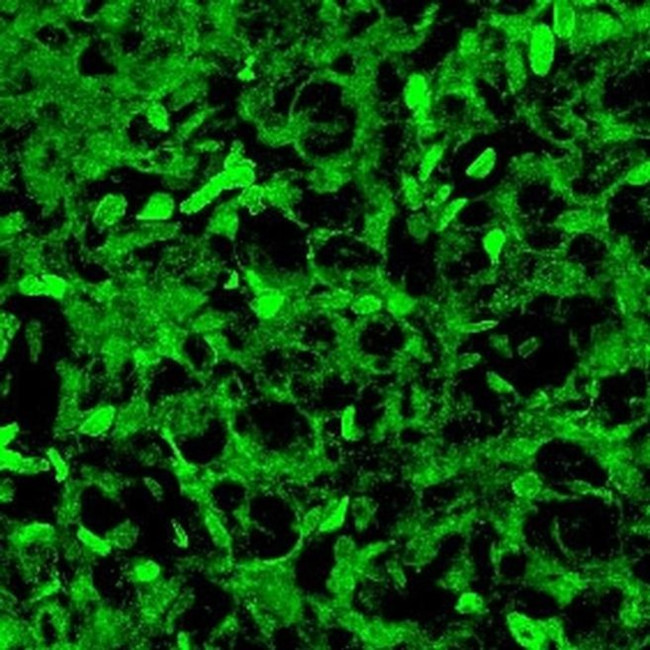 AANAT Antibody in Immunohistochemistry (IHC)