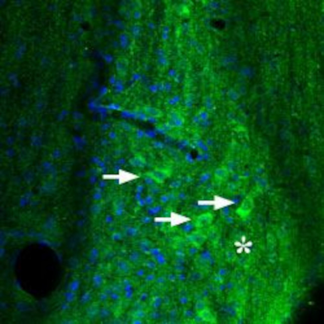 Adenosine A2A Receptor Antibody in Immunohistochemistry (Paraffin) (IHC (P))