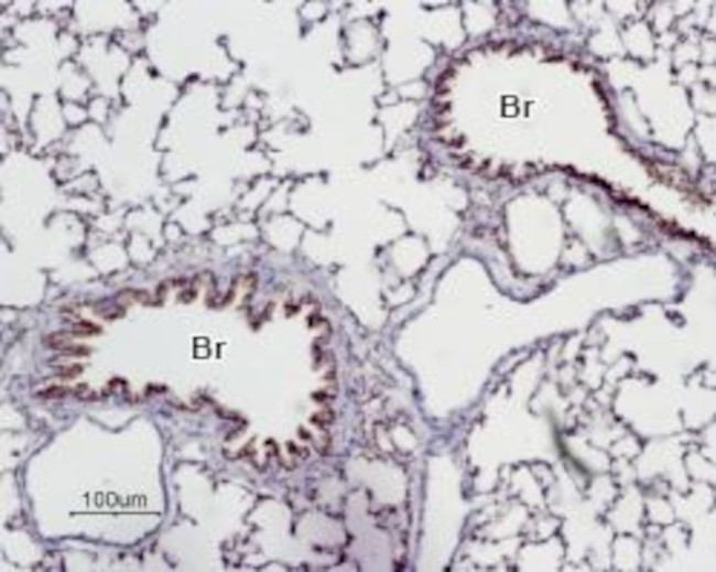 Adenosine A2A Receptor Antibody in Immunohistochemistry (Paraffin) (IHC (P))