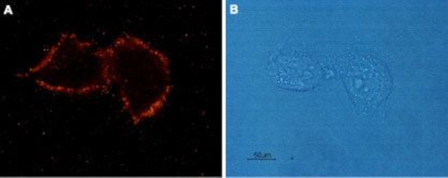 Angiotensin II Receptor Type-1 (extracellular) Antibody in Immunocytochemistry (ICC/IF)