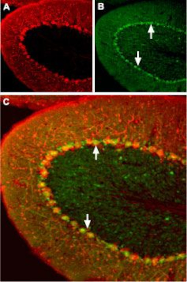 Angiotensin II Receptor Type-1 (extracellular) Antibody in Immunohistochemistry (IHC)