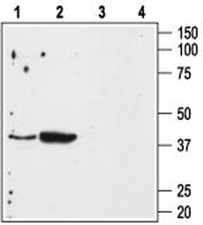 Angiotensin II Receptor Type-1 (extracellular) Antibody in Western Blot (WB)