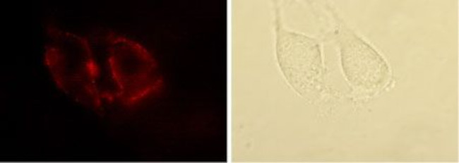 Angiotensin II Receptor Type-1 (extracellular) Antibody in Immunocytochemistry (ICC/IF)