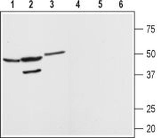 Angiotensin-(1-7) Mas Receptor Antibody in Western Blot (WB)