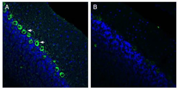 Renin Receptor/ATP6AP2 (extracellular) Antibody in Immunohistochemistry (Frozen) (IHC (F))