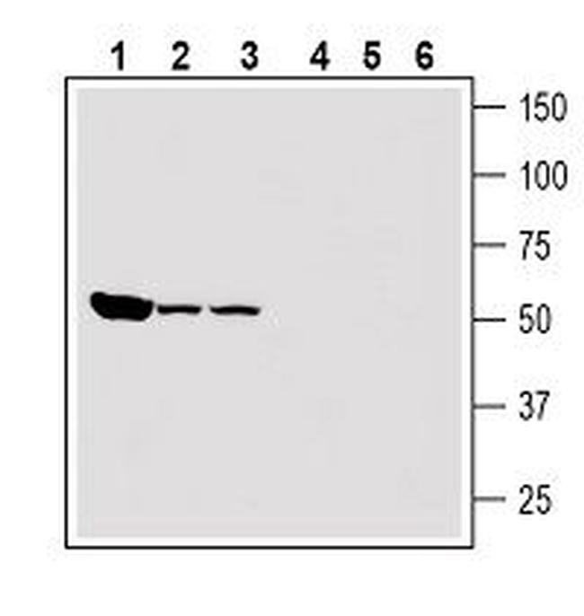 Renin Receptor/ATP6AP2 (extracellular) Antibody in Western Blot (WB)