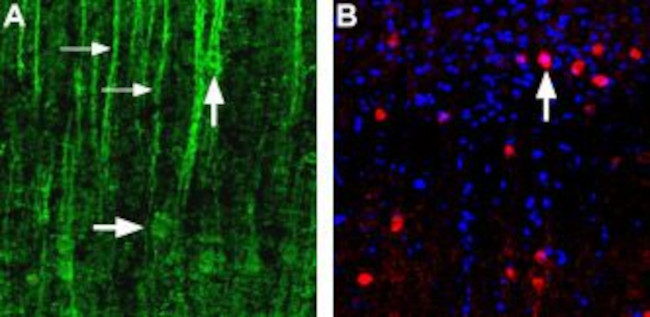 alpha 1D-Adrenergic Receptor (extracellular) Antibody in Immunohistochemistry (Paraffin) (IHC (P))