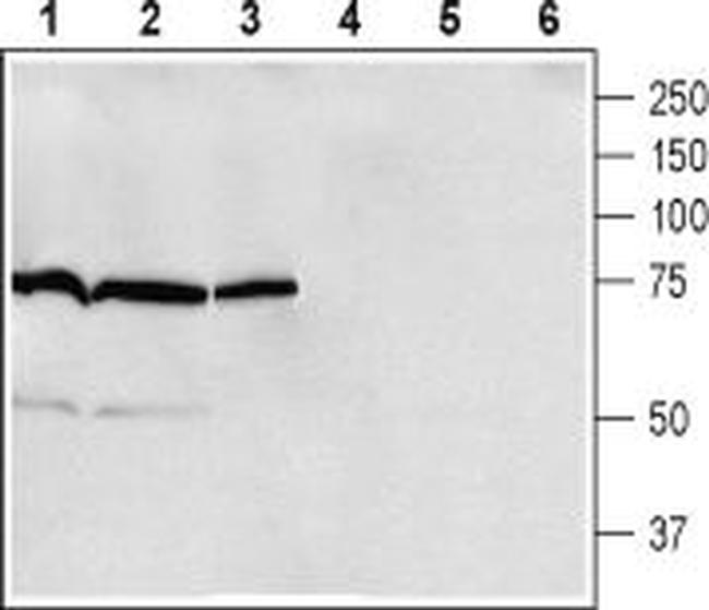 beta 1-Adrenergic Receptor (extracellular) Antibody in Western Blot (WB)