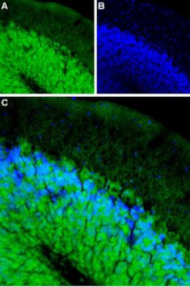 beta 1-Adrenergic Receptor (extracellular) Antibody in Immunohistochemistry (IHC)