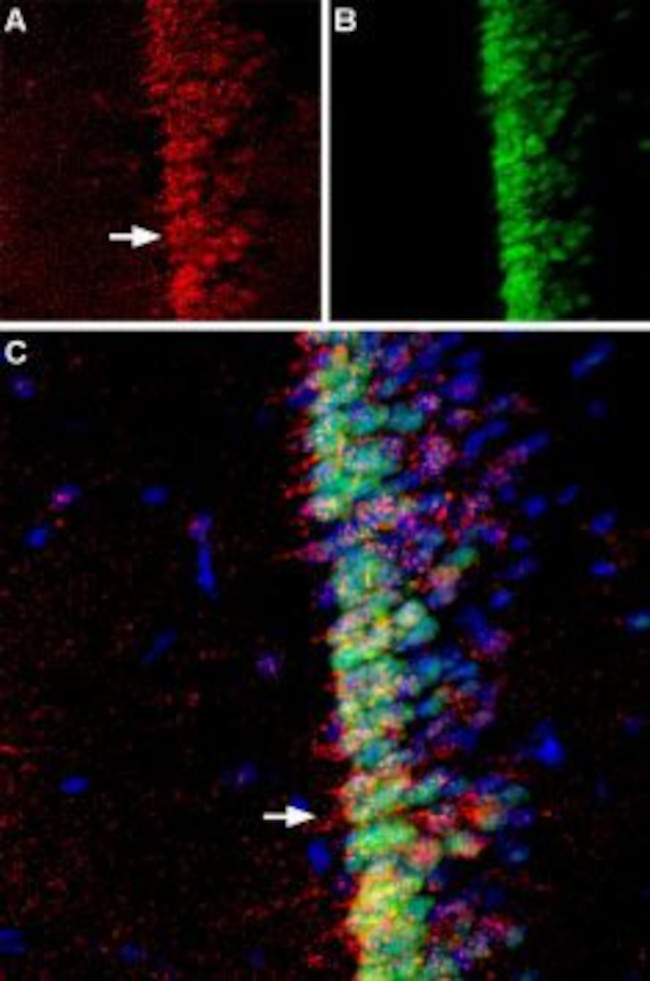 Adenylate Cyclase 3 (AC3) (extracellular) Antibody in Immunohistochemistry (IHC)