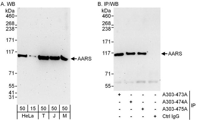 AARS Antibody in Western Blot (WB)