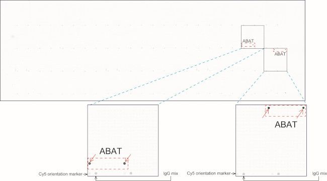 ABAT Antibody in Peptide array (ARRAY)