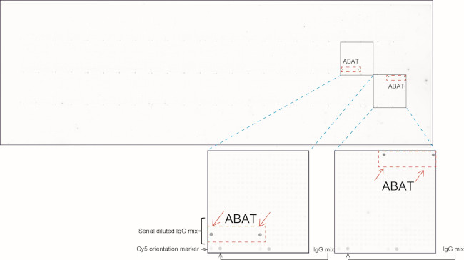 ABAT Antibody in Peptide array (ARRAY)