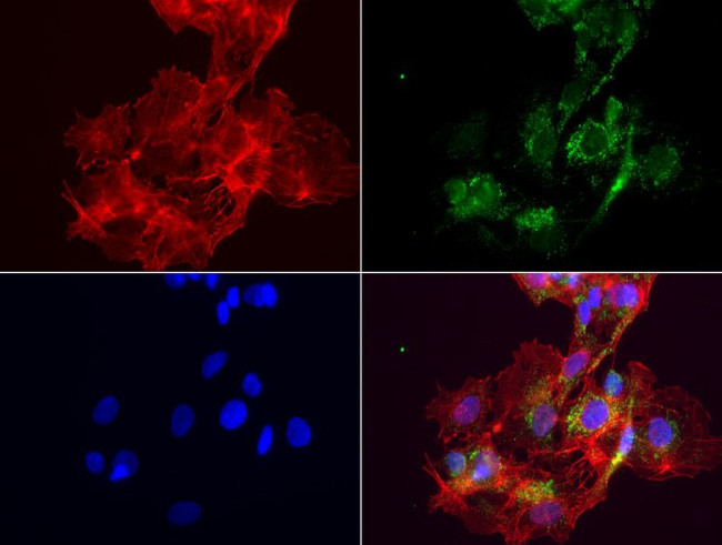 ABAT Antibody in Immunocytochemistry (ICC/IF)