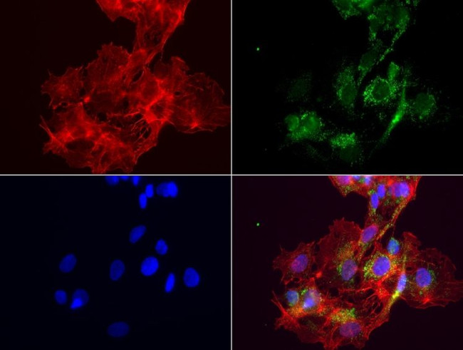 ABAT Antibody in Immunocytochemistry (ICC/IF)